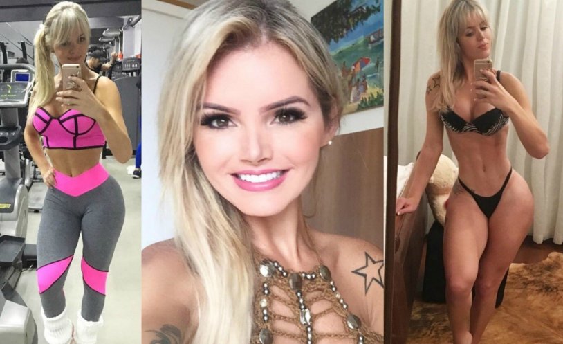 Talita Zapirolly before surgery