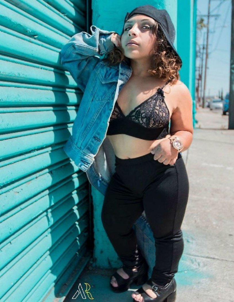 Dwarf model Drew Prest