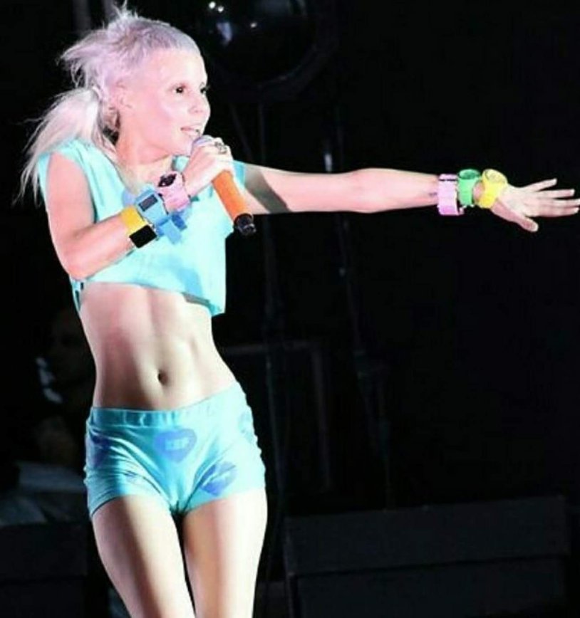 Die Antwoord soloist 18