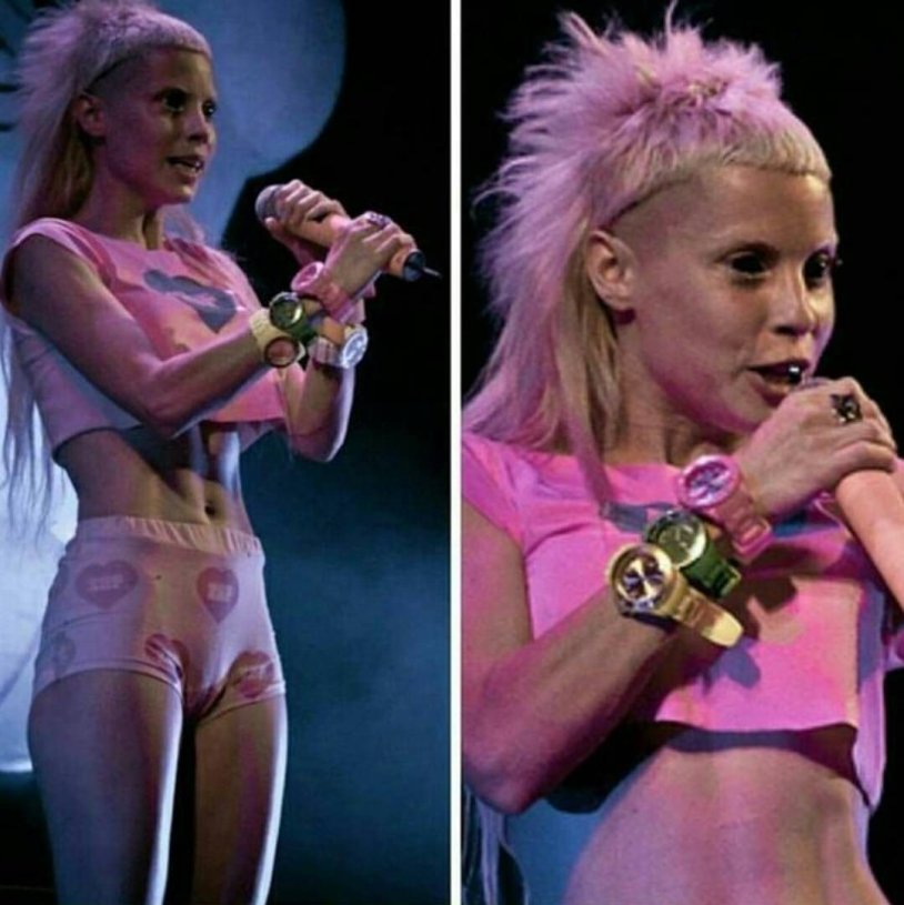 Die Antwoord soloist