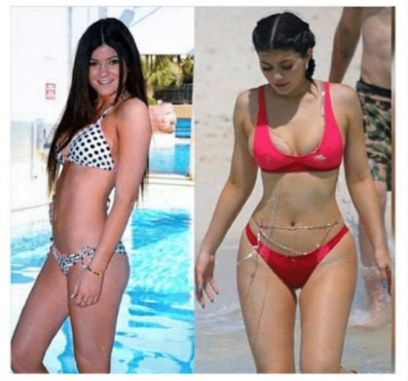Kylie Jenner body before and after