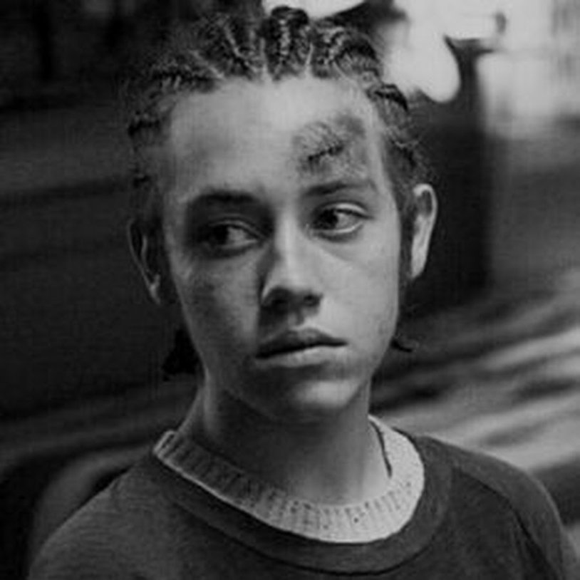 Carl Gallagher with dreadlocks