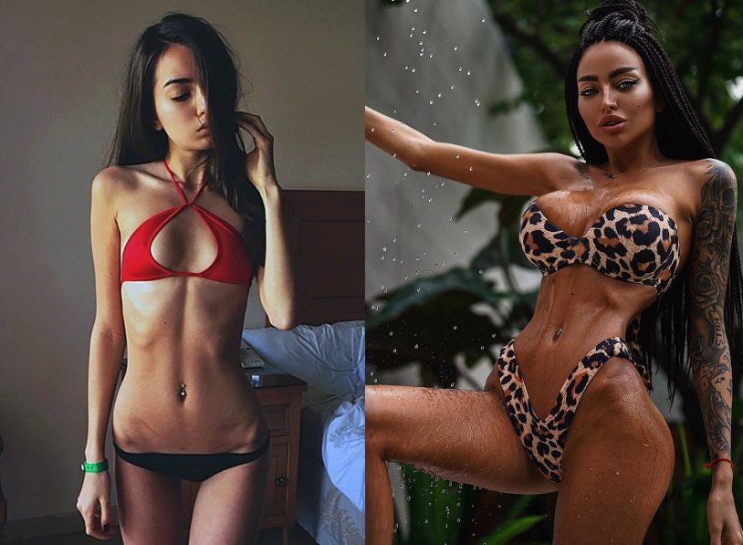 Alena Omovich before plastic surgery