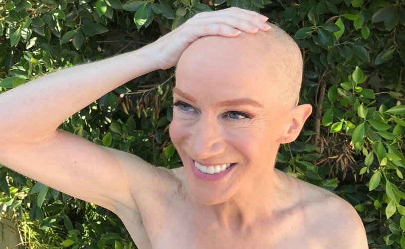 Kathy griffin bald