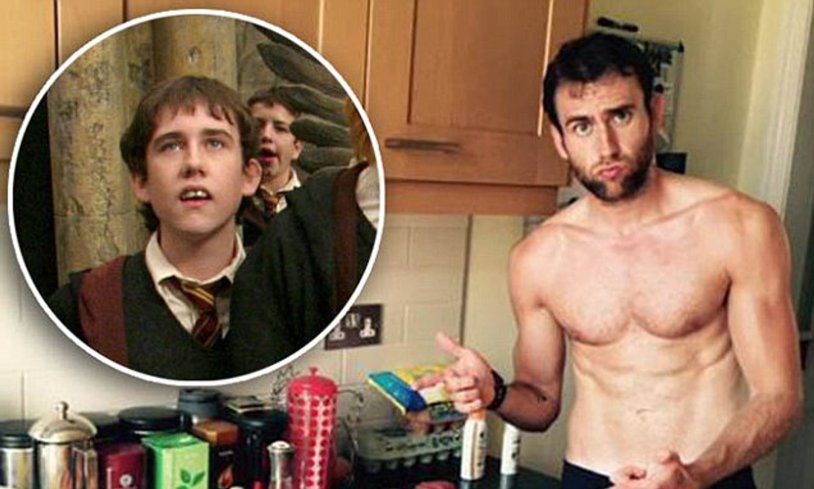 Neville Longbottom Torso