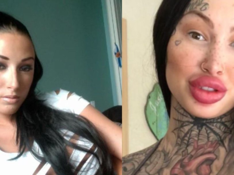 Mary Magdalene plastic surgery victim