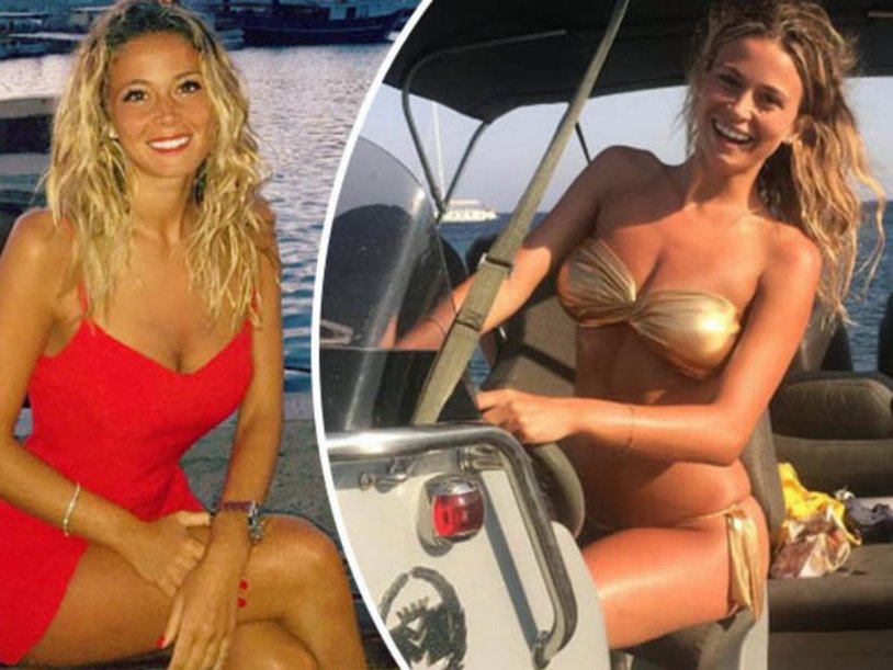 Diletta Liotta before plastic surgery