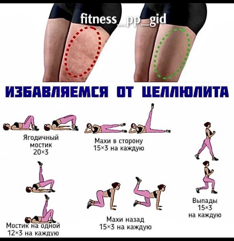 Cellulite exercises on legs