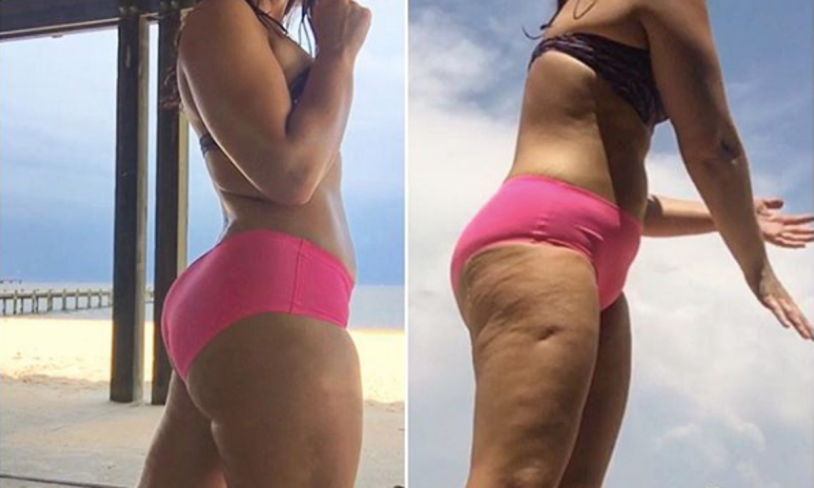 Swimsuit for cellulite ass
