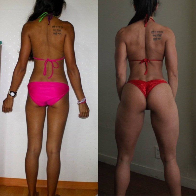 Pumped up buttocks before and after