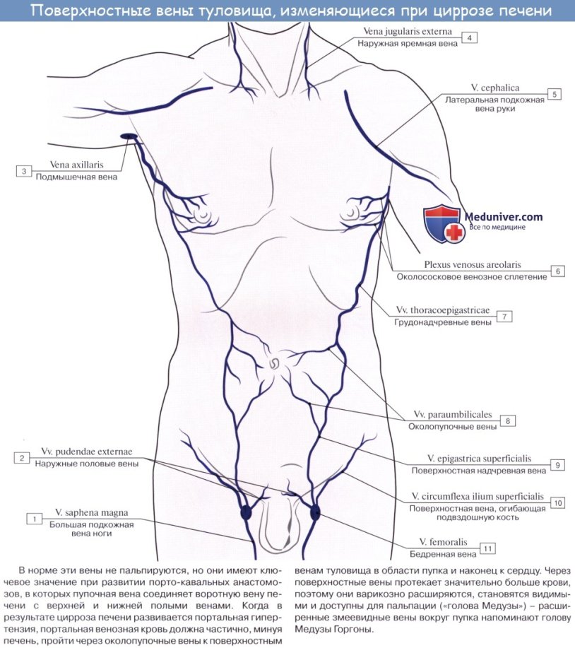 Veins of the anterior abdominal wall anatomy
