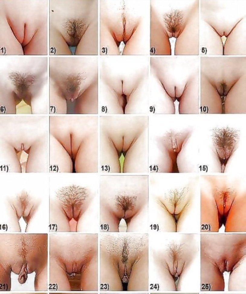 Type of pussy
