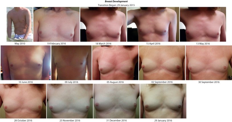 Amateur photo Puberty