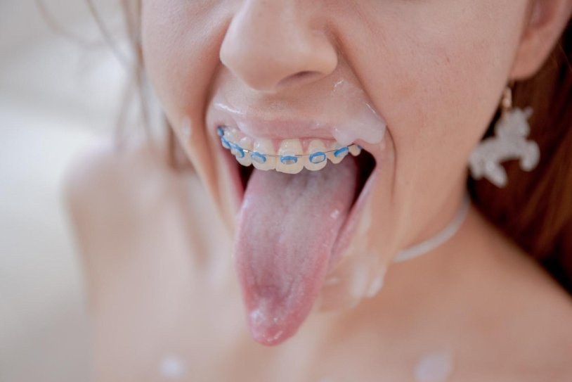 Girls with cumshot braces