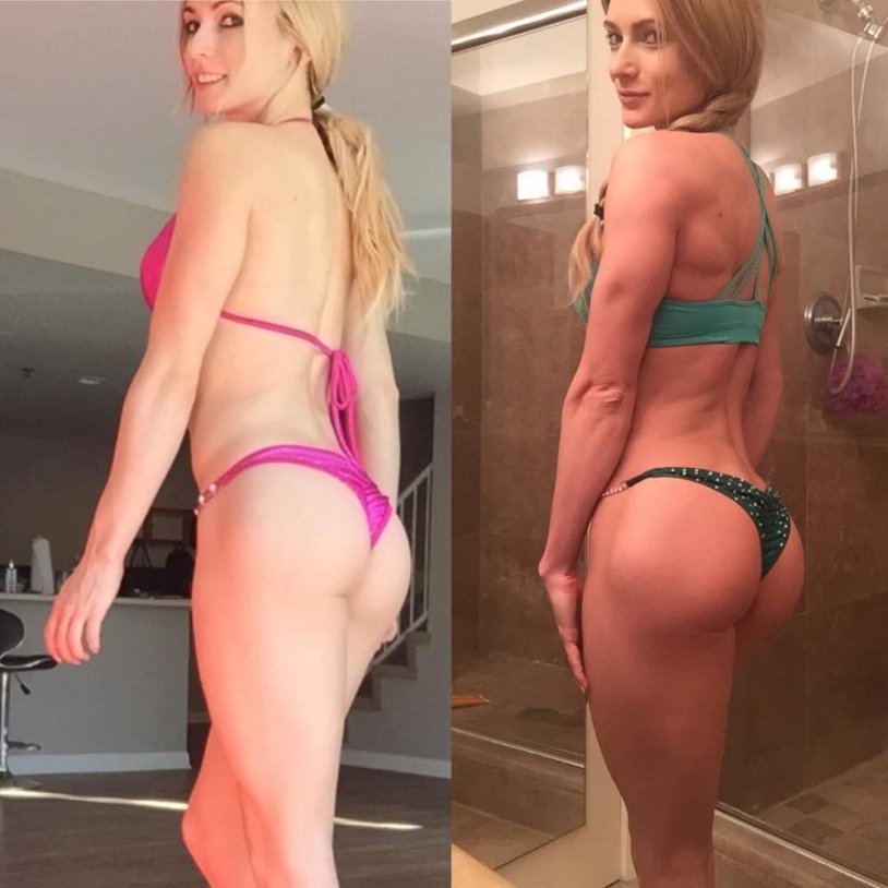 Alyssa germeroth breast plastic