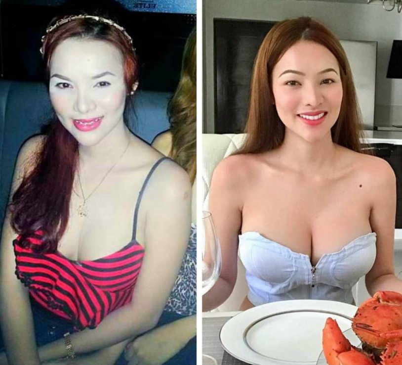 Sunshine guimary drain 18