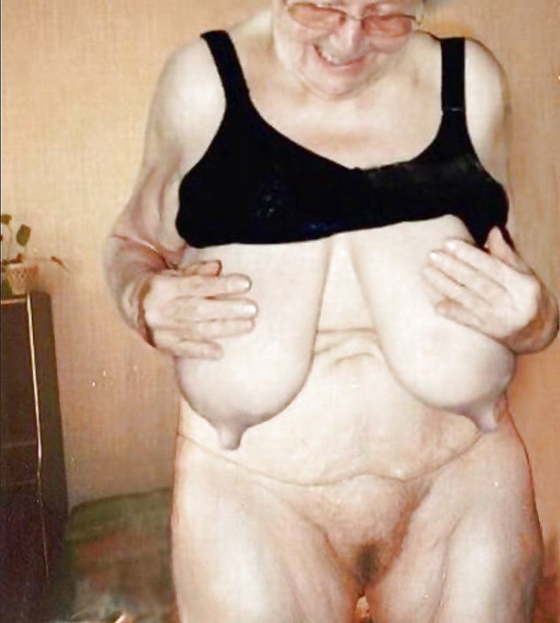 Naked old women with macromastia