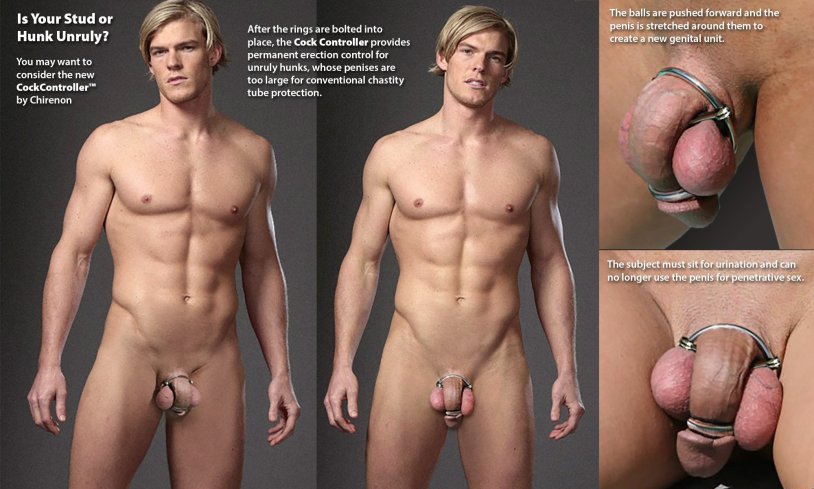 Chastity reduction of the penis before and after