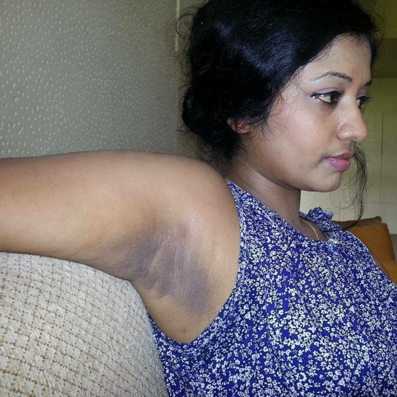 Ketiak Tante Berkeringat