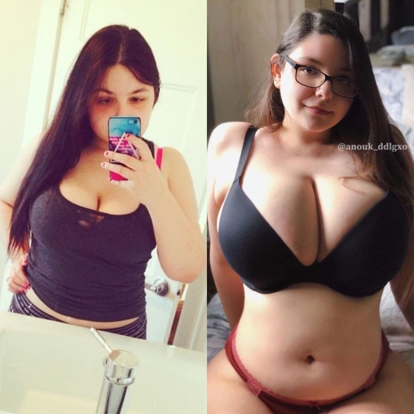 Anouk ddlgxo breast