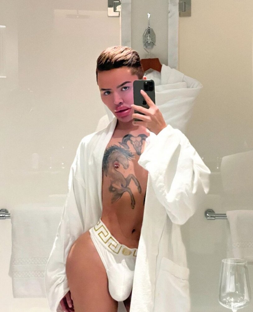 Man with pumped up lips